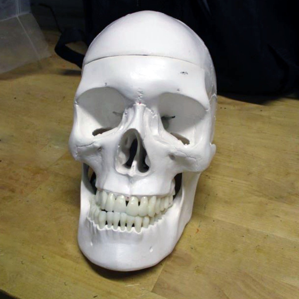 A surgeon's training aid skull used to practice lobotomies. 